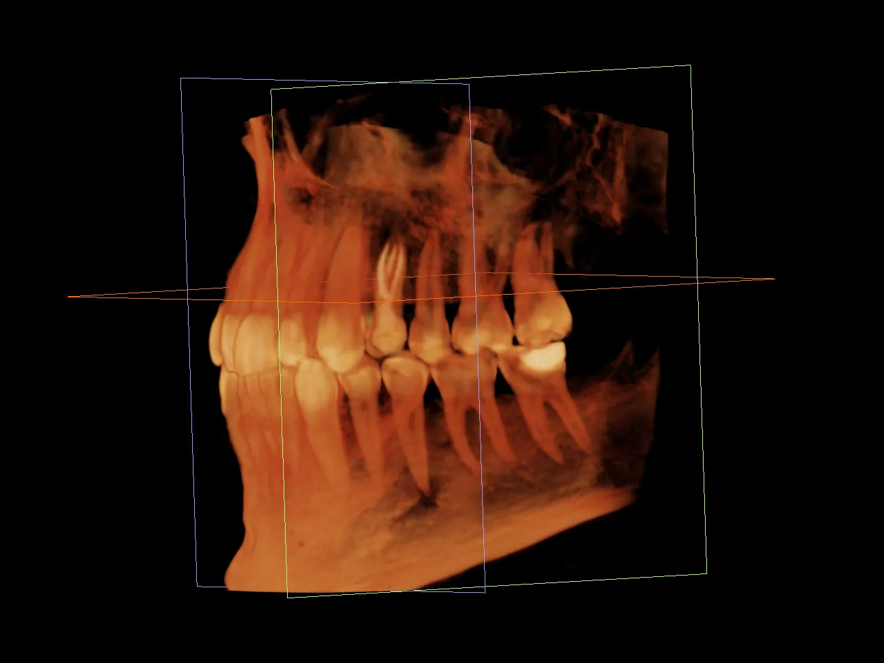 Dokumentacja protokołów leczenia endodontycznego krok po kroku.